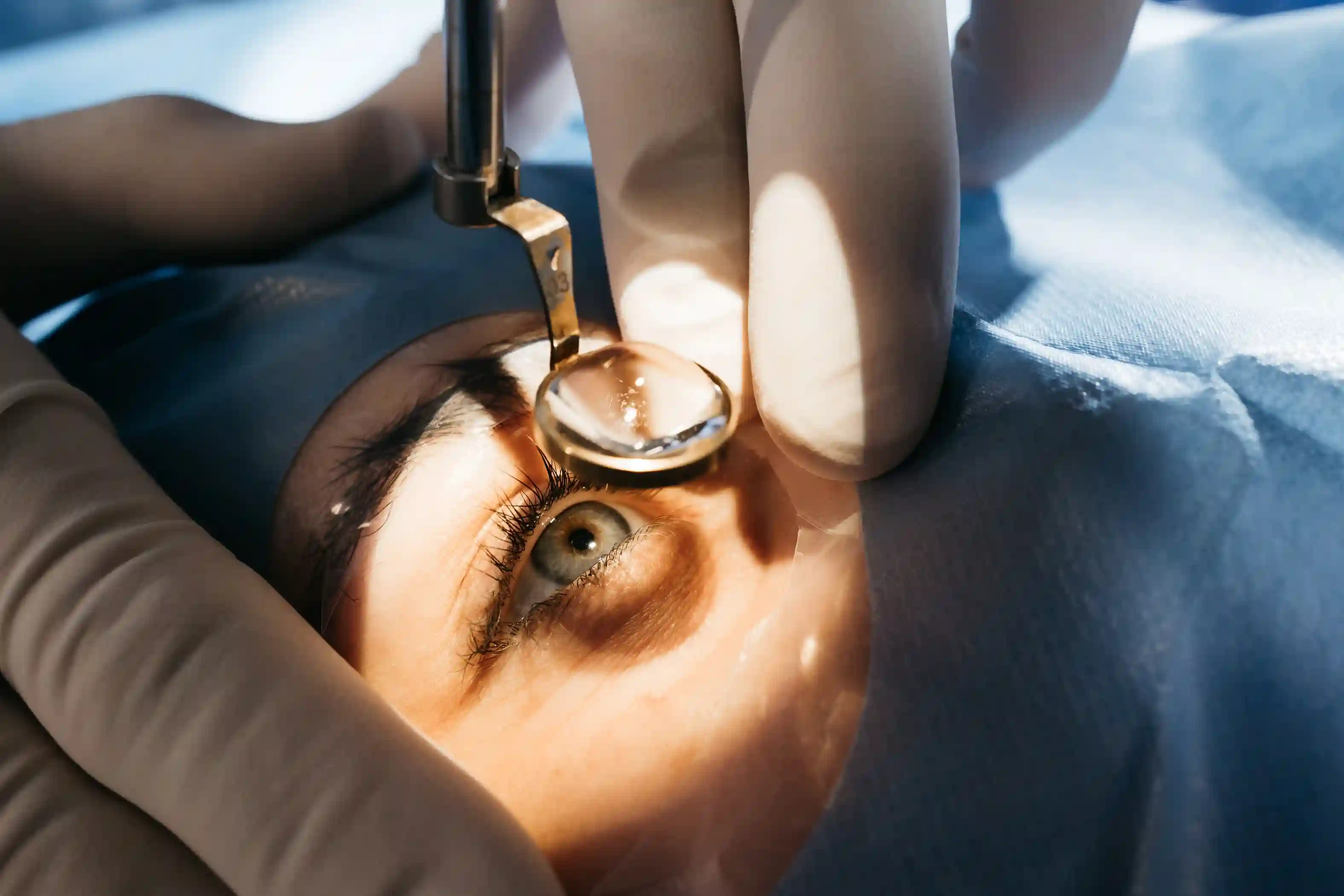 Laser Eye Treatment