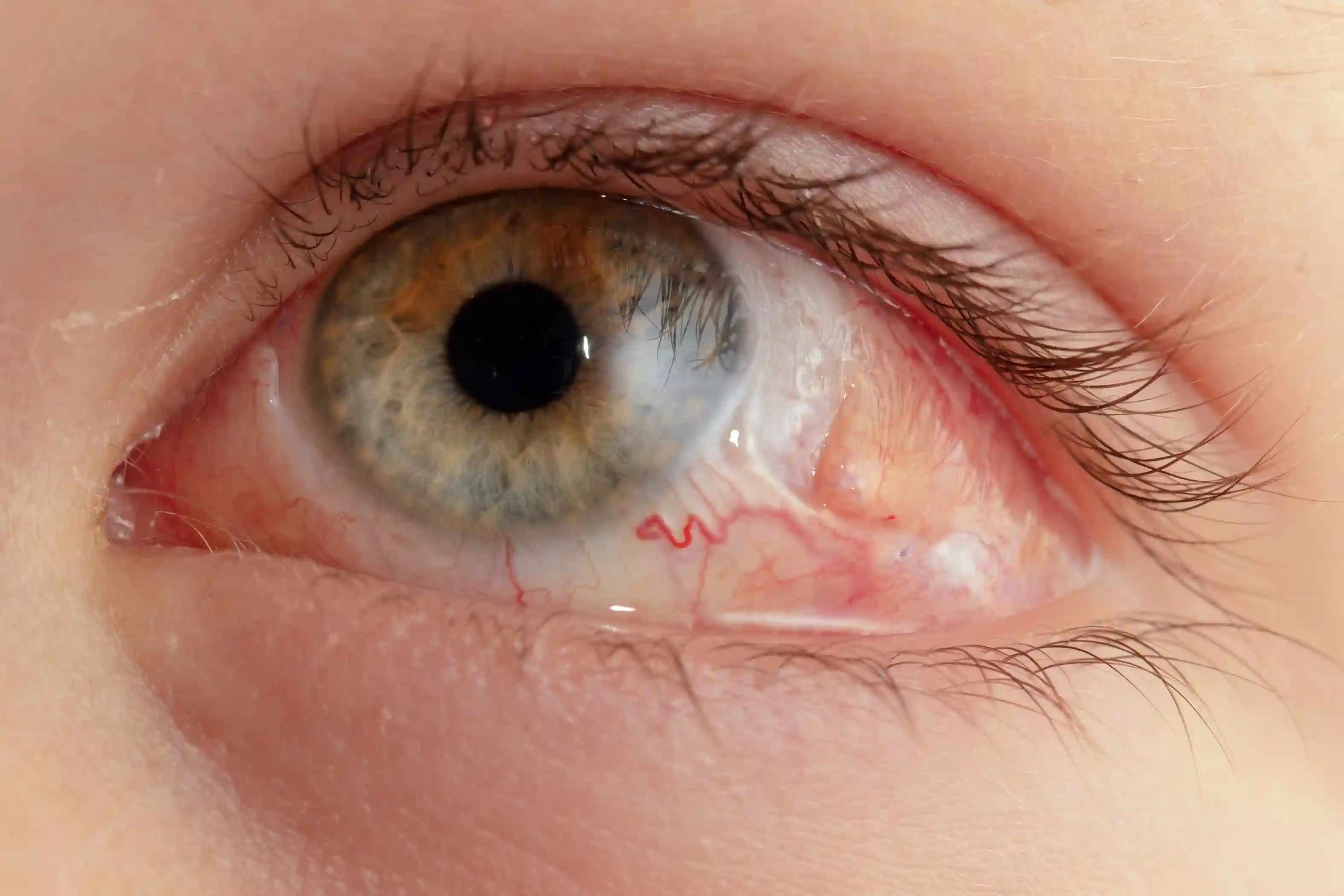 Red Eyes