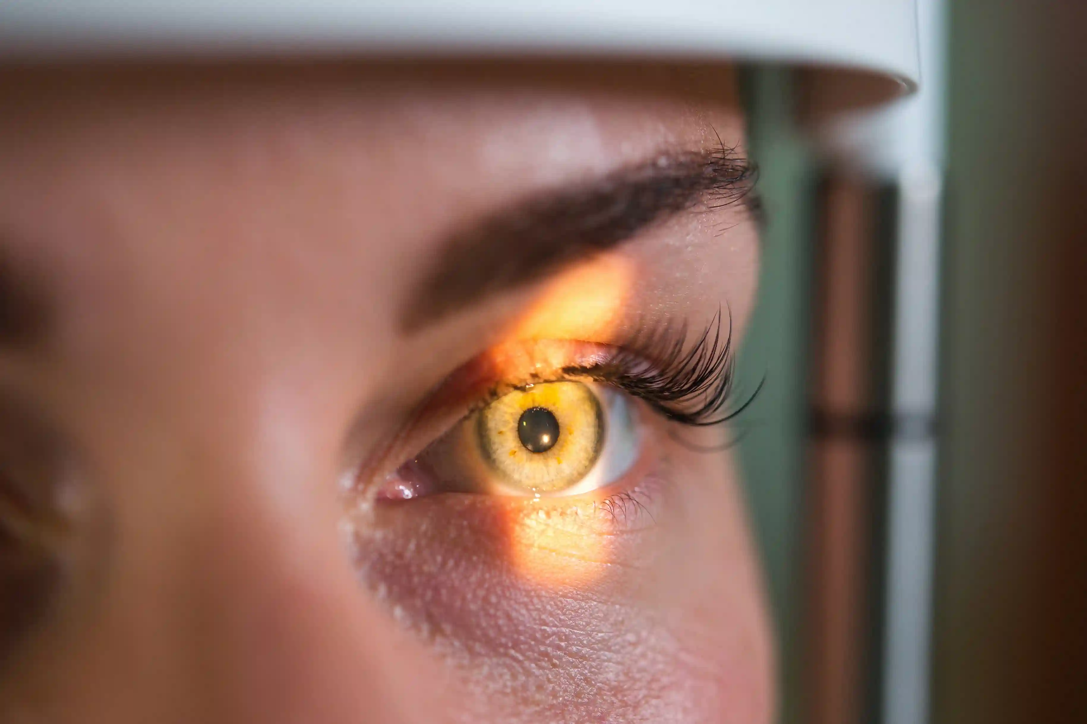 Retinal Vessel Occlusion